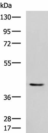 Western blot analysis of Mouse heart tissue lysate using STK32A Polyclonal Antibody at dilution of 1:1000
