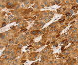 Anti-Human/Mouse LTB Antibody - ABMIUM