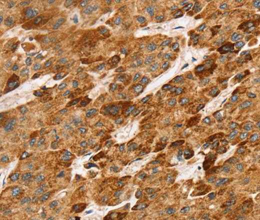 Anti-Human/Mouse LTB Antibody