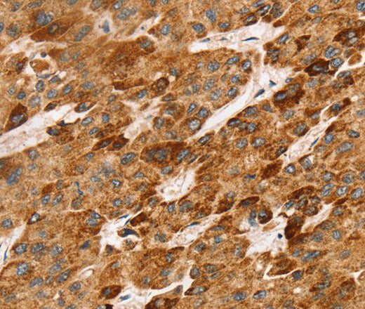 Anti-Human/Mouse LTB Antibody - ABMIUM