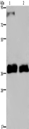 Anti-Human FETUB Antibody - ABMIUM