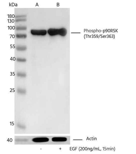 Anti-Human RPS6KA1 Antibody [A1270] - ABMIUM