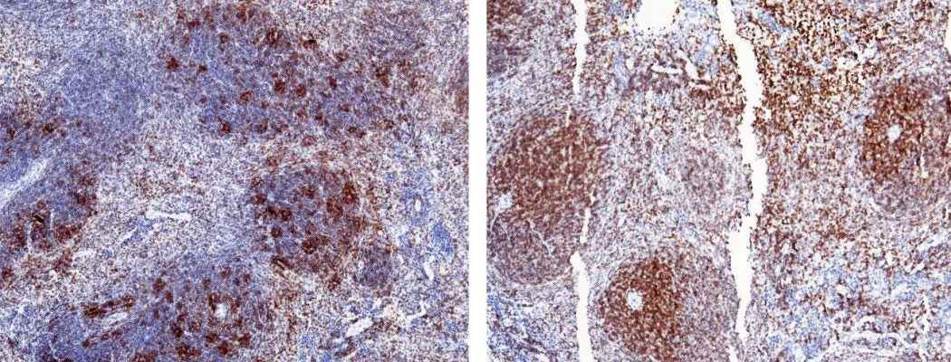 Anti-Mouse CD2 Antibody [B462] - ABMIUM