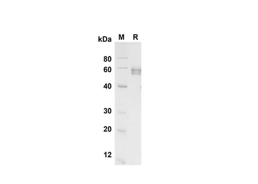SDS-PAGE analysis of Human EpCAM/TROP-1 proteins , 2 μg/lane of Recombinant Human EpCAM/TROP-1 proteins was resolved with SDS-PAGE under reducing conditions , showing bands at 60 kDa.