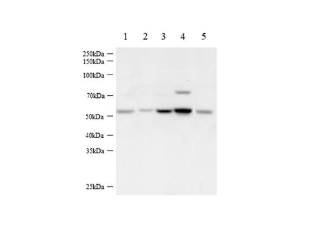 Anti-Human/Mouse/Rat BECN1 Antibody - ABMIUM