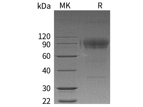 Recombinant Human IL2RG/CD132 Protein (aa 23-262, Fc Tag) - ABMIUM