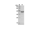 SDS-PAGE analysis of Human IL-11 proteins, 2 μg/lane of Recombinant Human IL-11 proteins was resolved with SDS-PAGE under reducing conditions, showing bands at 39 kDa.