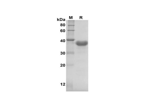 SDS-PAGE analysis of Human IL-11 proteins, 2 μg/lane of Recombinant Human IL-11 proteins was resolved with SDS-PAGE under reducing conditions, showing bands at 39 kDa.