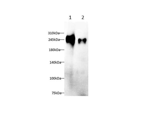 Anti-Human FN1 Antibody - ABMIUM