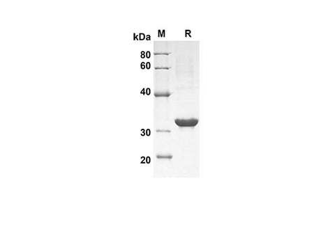 SDS-PAGE analysis of Mouse CCL6/C10 proteins , 2 μg/lane of Recombinant Mouse CCL6/C10 proteins was resolved with SDS-PAGE under reducing conditions , showing bands at 32 kDa.