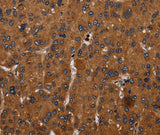 Anti-Human/Mouse CYBB Antibody - ABMIUM