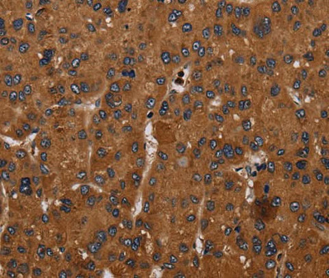 Anti-Human/Mouse CYBB Antibody - ABMIUM