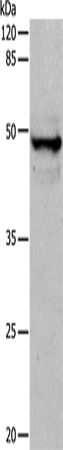 Anti-Human/Mouse/Rat KRT15 Antibody - ABMIUM