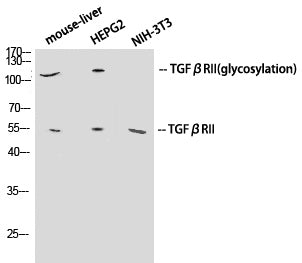 Western Blot analysis of various cells using TGF β Receptor II Polyclonal Antibody at dilution of 1:1000.