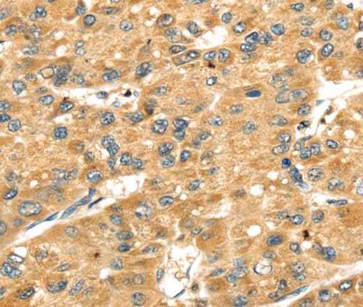 Anti-Human/Mouse/Rat SH3KBP1 Antibody
