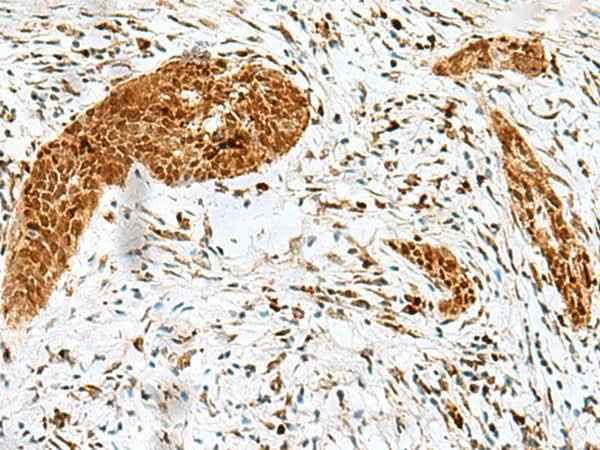 Anti-Human/Mouse HMG20A Antibody