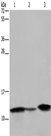 Anti-Human/Mouse/Rat FABP2 Antibody - ABMIUM