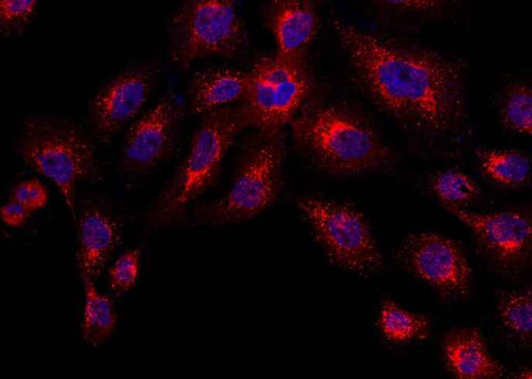 Anti-Human CTSD Antibody [B348] - ABMIUM