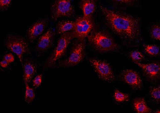 Anti-Human CTSD Antibody [B348] - ABMIUM