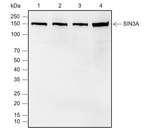 Anti-Human/Rat/Mouse SIN3A Antibody [A779] - ABMIUM