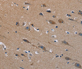 Anti-Human/Mouse PLXND1 Antibody - ABMIUM