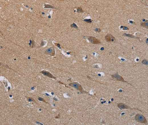 Anti-Human/Mouse PLXND1 Antibody
