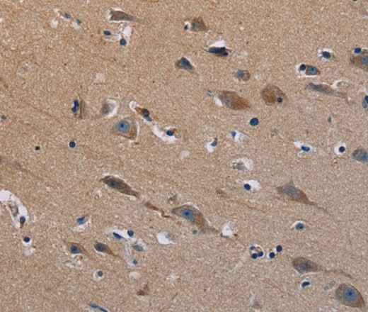 Anti-Human/Mouse PLXND1 Antibody