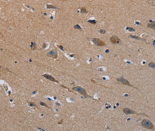 Anti-Human/Mouse PLXND1 Antibody - ABMIUM