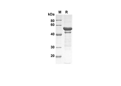 SDS-PAGE analysis of Human ITGAX proteins , 2 μg/lane of Recombinant Human ITGAX proteins was resolved with SDS-PAGE under reducing conditions , showing bands at 56 kDa.