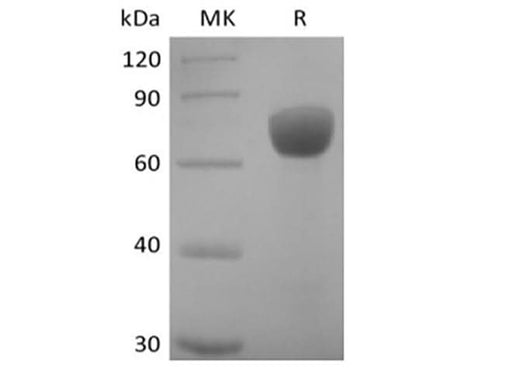 Recombinant Human SLAM Family Member 7/SLAMF7/CD319/CRACC (C-mFc) - ABMIUM