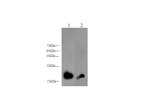 Anti-Human/Mouse/Rat ADIPOQ Antibody - ABMIUM
