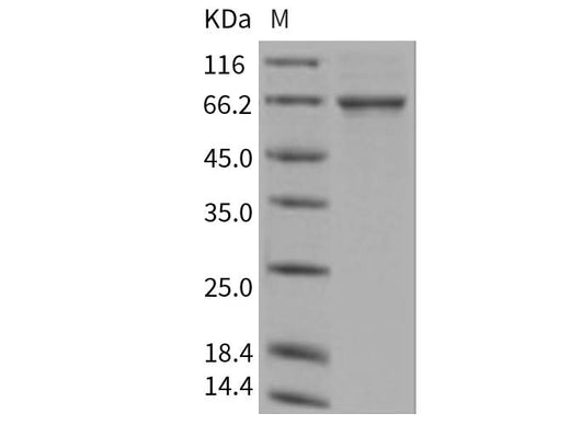 > 75 % as determined by reducing SDS-PAGE.