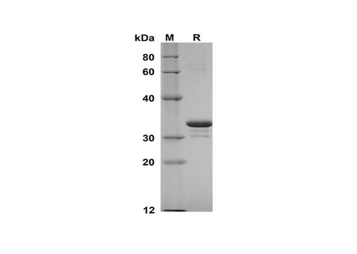 SDS-PAGE analysis of Human ST14/Matriptase proteins, 2 μg/lane of Recombinant Human ST14/Matriptase proteins was resolved with SDS-PAGE under reducing conditions, showing bands at 33 kDa.