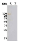 Anti-Human NRG1 Antibody [A935] - ABMIUM