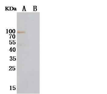 Anti-Human NRG1 Antibody [A935] - ABMIUM