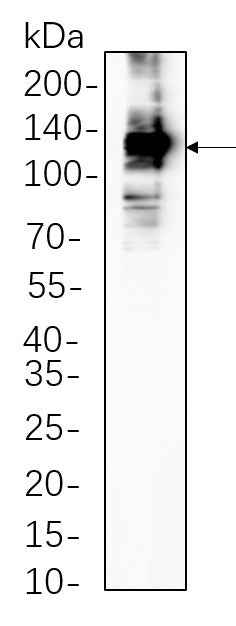 Anti-Human/Mouse/Rat iNOS Antibody [1A7] - ABMIUM