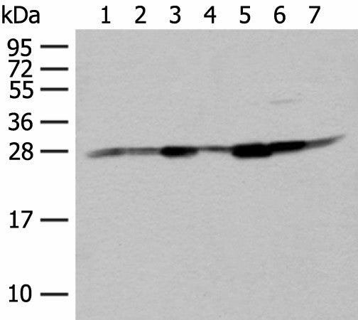 Western blot analysis of Hela HT-29 and HEPG2 cell Human liver tissue Human fetal liver tissue Mouse liver tissue and Human fetal brain tissue lysates using NIPSNAP2 Polyclonal Antibody at dilution of 1:400