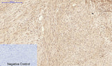 Immunohistochemistry of paraffin-embedded Human uterus tissue using ATG7 Monoclonal Antibody at dilution of 1:200.