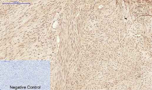 Anti-Human/Mouse/Rat ATG7 Antibody [1A1]