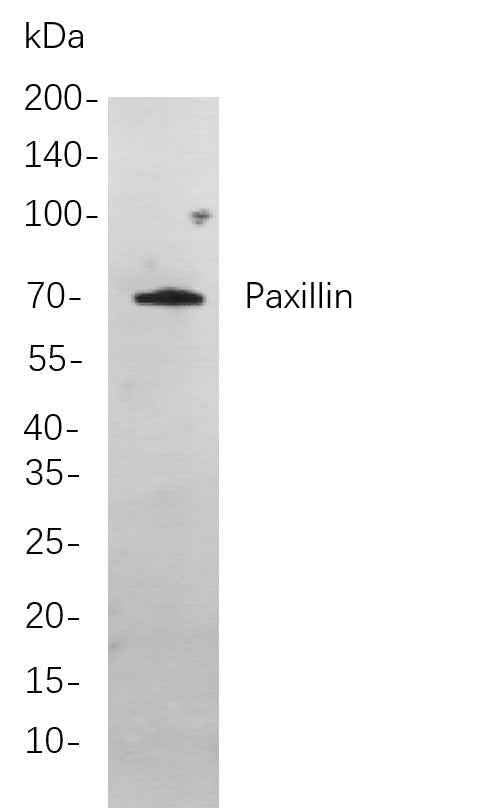 Anti-Human/Mouse/Rat Paxillin Antibody [B881] - ABMIUM