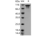 > 85 % as determined by reducing SDS-PAGE.