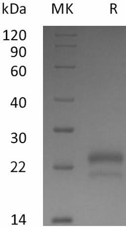 Recombinant Human VEGF165/VEGFA Protein - ABMIUM