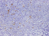 Anti-Human CD68 Antibody - ABMIUM