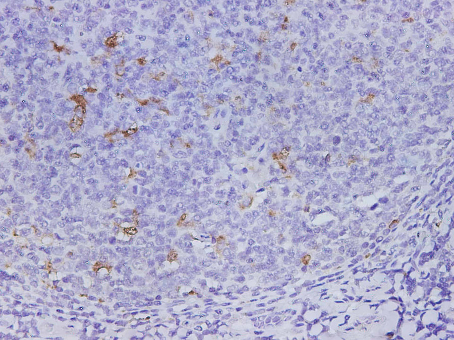 Anti-Human CD68 Antibody - ABMIUM