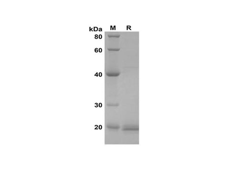 SDS-PAGE analysis of Mouse Epiregulin proteins, 2 μg/lane of Recombinant Mouse Epiregulin proteins was resolved with SDS-PAGE under reducing conditions, showing bands at 20 kDa.