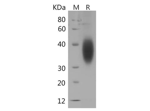 SDS-PAGE analysis of Human B7-H5/Gi24/VSIR proteins, 2 μg/lane of Recombinant Human B7-H5/Gi24/VSIR proteins was resolved with SDS-PAGE under reducing conditions, showing bands at 30-50 kDa.