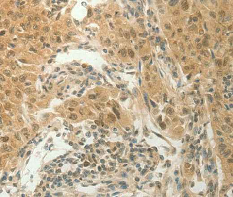 Anti-Human SLC8A3 Antibody