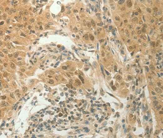 Anti-Human SLC8A3 Antibody