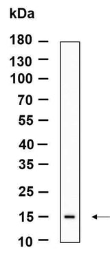 Anti-Human/Mouse LGALS14 Antibody [B961]