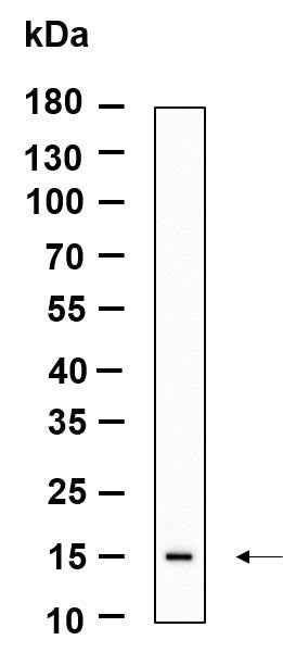 Anti-Human/Mouse LGALS14 Antibody [B961] - ABMIUM